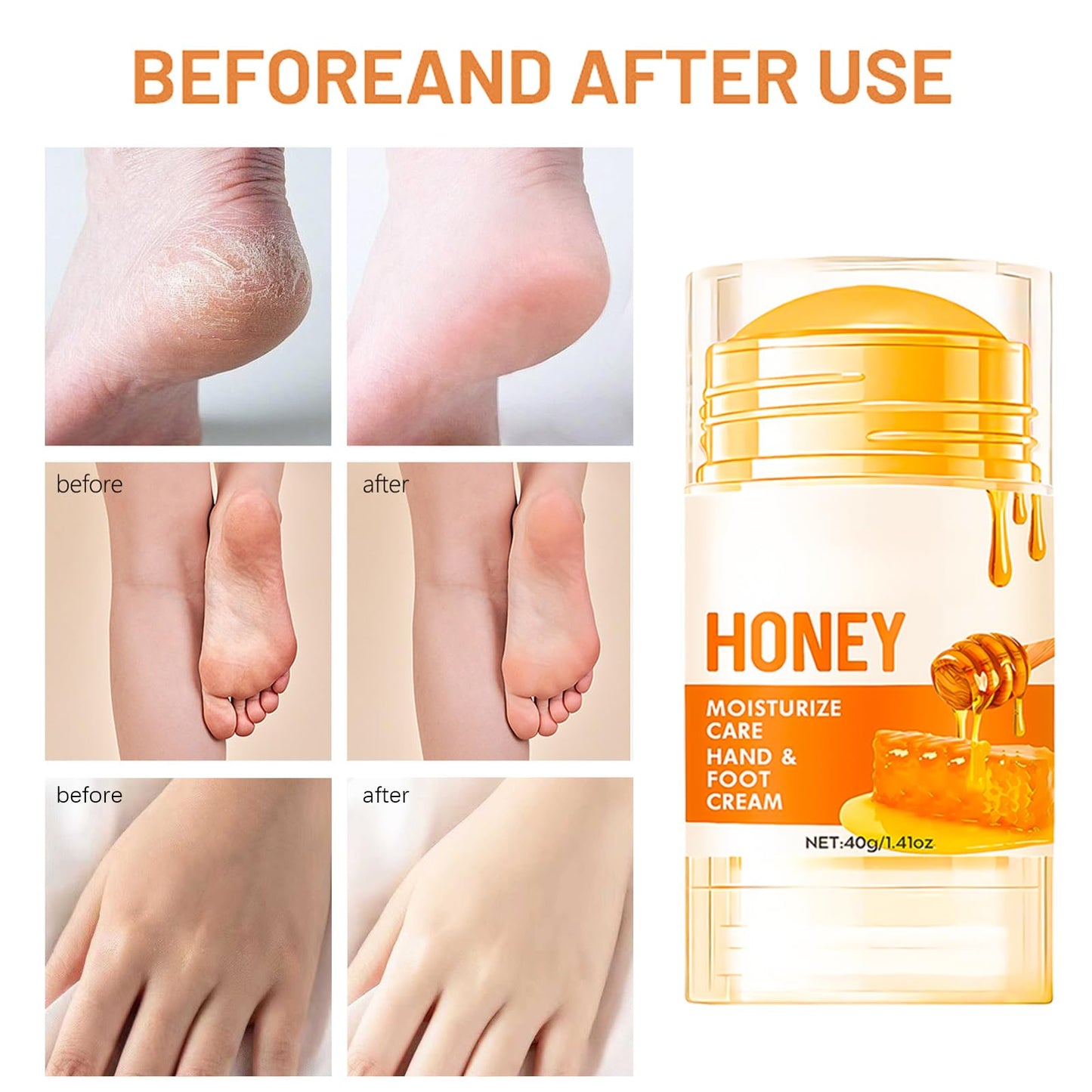 FresFresi Honey Foot Cream – Moisturizer for Dry Hands & Cracked Heels. Deep Repair & Hydration for Rough Skin – Fast-Absorbing Formula for Women & Men