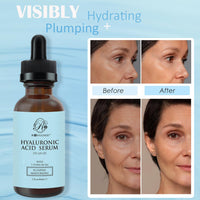 ROSVANEE Hyaluronic Acid Serum for Face 60ml, 5% Hyaluronic Acid + Vitamin B5 with Niacinamide, Anti Aging Serum Intense Hydration Moisture, Vegan and Paraben-Free