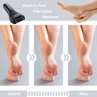 Bemece Electric Foot File Callus Remover, Professional Rechargeable Waterproof Pedicure Kit with 10 in 1 Foot Files Pedicure Tools Set for Cracked Heels Calluses and Dead Skin…（Gifting Recommendation）