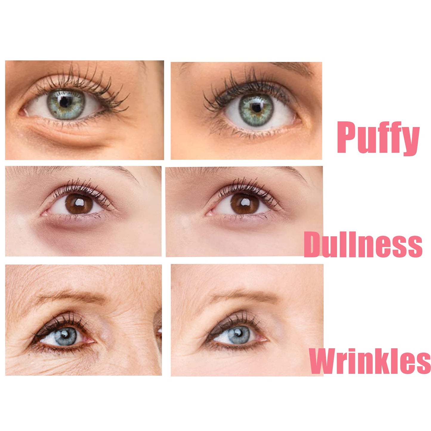 Brighten Eye Cream Stick,Rosehip Moisturizing Balm Stick,Hydrating Moisturizing Stick,Eye Cream for Dark Circles And Puffy Eyes & Wrinkles,Multi Eye Balm,Wrinkles,Lift Eye Line & Anti-Aging