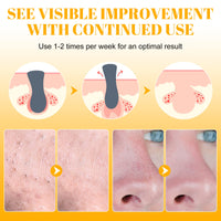 Tioueo Nose Strips 80 Packs, Blackhead Remover Pore Strips, Blackhead Pore Strip, Deep Cleansing Nose Strips for Clearer Skin White