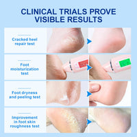 INSKIN 42% Urea Foot Cream, 2% Acids Foot Cream For Cracked Heels And Dry Skin, Foot Moisturiser Foot Cream For Hard Skin, Urea Cream Soften, Cracked Heel Cream Heel Balm For Foot And Body Care