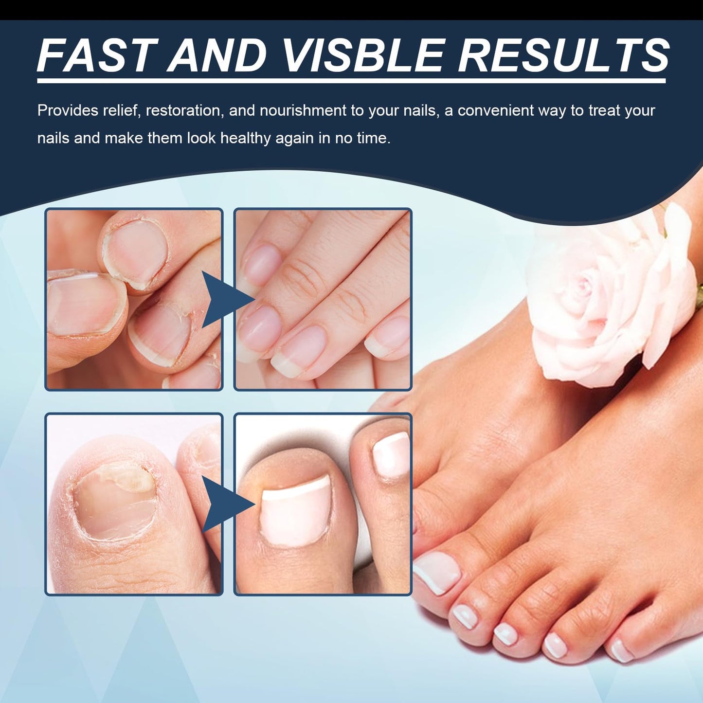 Nail Strengthener, 2PCS Revitalizing Nail Growth Serum, Nail Hardener Extra Strong and Growth - Nail Repair Serum for Damaged Nails for Faster Growth - Achieve Stronger, Healthier Nails