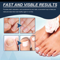 Nail Strengthener, 2PCS Revitalizing Nail Growth Serum, Nail Hardener Extra Strong and Growth - Nail Repair Serum for Damaged Nails for Faster Growth - Achieve Stronger, Healthier Nails