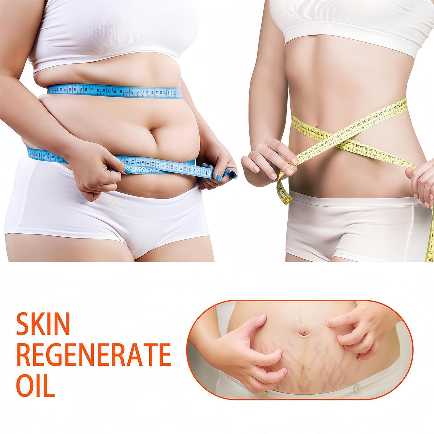 125ml Stretch Mark Oil & Scar Treatment, Skin Regeneration Oil for Stretch Marks Removal, Firming & Lifting, Collagen Boost - Body Oil for Women