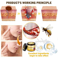 OXGPAL Bee Venom Skin Restoration Cream, Bee Venom Comprehensive Creams, Firming Moisturizing & Repair Reduces Blemishes for All Skin Type (2 Bottle*60ML)