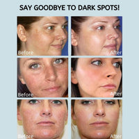 Haiyox Dark Spot Correcting Serum For Face Hydrating With 5% Niacinamide,Dark Spot Correcting Niacinamide,Brightening Serum For Korean Skincare Uneven Skin Tone,Improve Dull Skin,Fades Blemish(50ml)