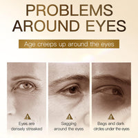 OKAQEE Collagen Under Eye Gel Patches - Hydrating Under Eye Patches with Hyaluronic Acid - Freeze Drying Collagen Eye Masks for Puffy Eyes, Fine Lines & Dark Circles - Eye Bags Remover for Women