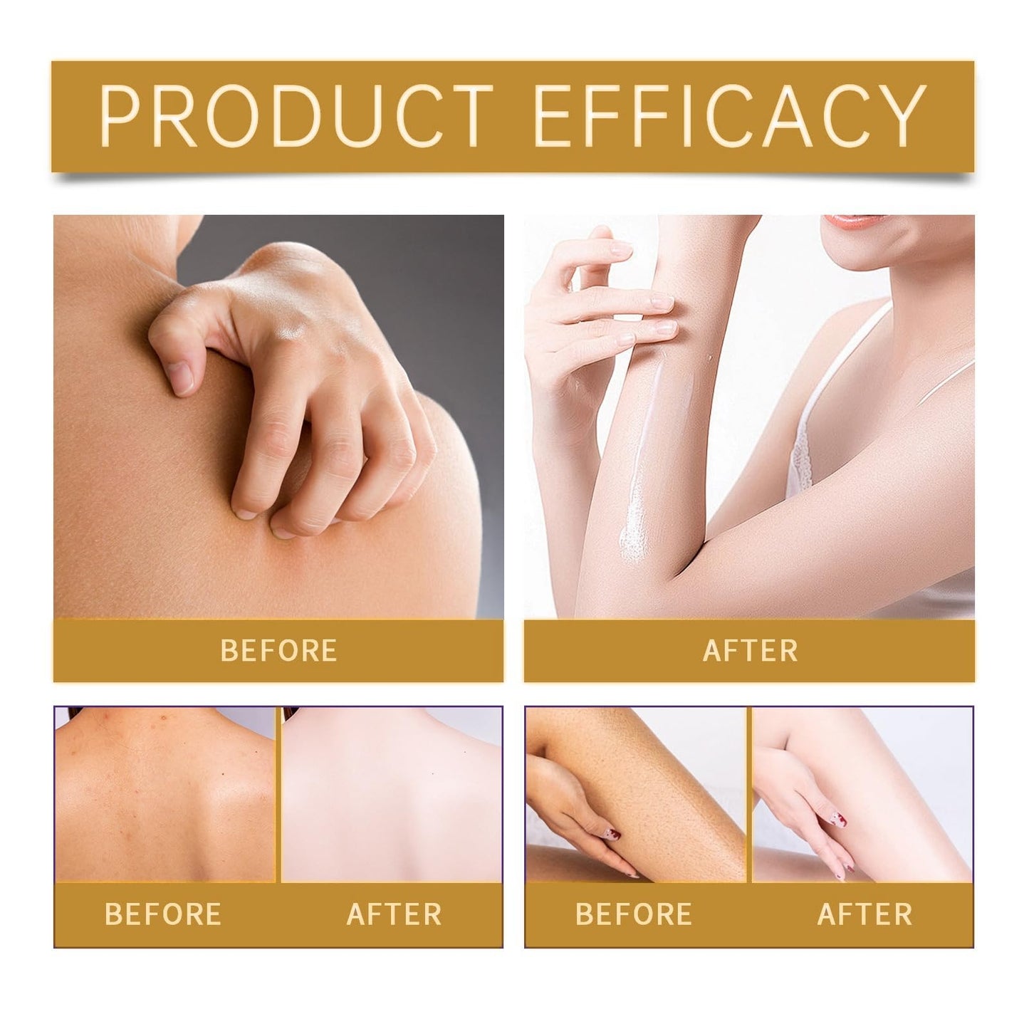 Bee Ve-nom Cream,Bee V-enom Treatment Cream,Professional Bee V-enom Repair Cream,Natural Moisturizing Cream for All Parts of The Body,Soothing Bee V-enom Removal Cream,Fast-Acting Bee Ve-nom Cream