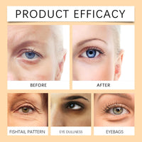 LaluluTek Turmeric Retinol Eye Stick - Under Eye Cream for Dark Circles and Puffy Eyes - Anti Wrinkle and Firming Formula - Reduces the Growth of Fine Lines - Anti Aging - Turmeric Eye Cream Stick