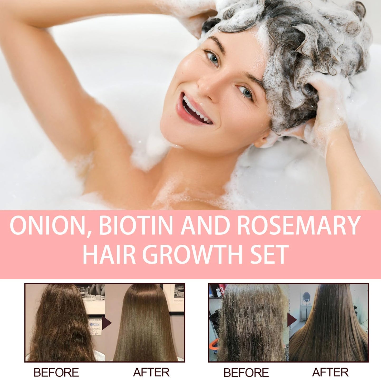 DMQ Shampoo and Conditioner Sets,Onion, Biotin and Rosemary Hair Growth Set,Hair Growth Shampoo for Hair Loss and Thinning Hair, Hair Care for All Hair Types
