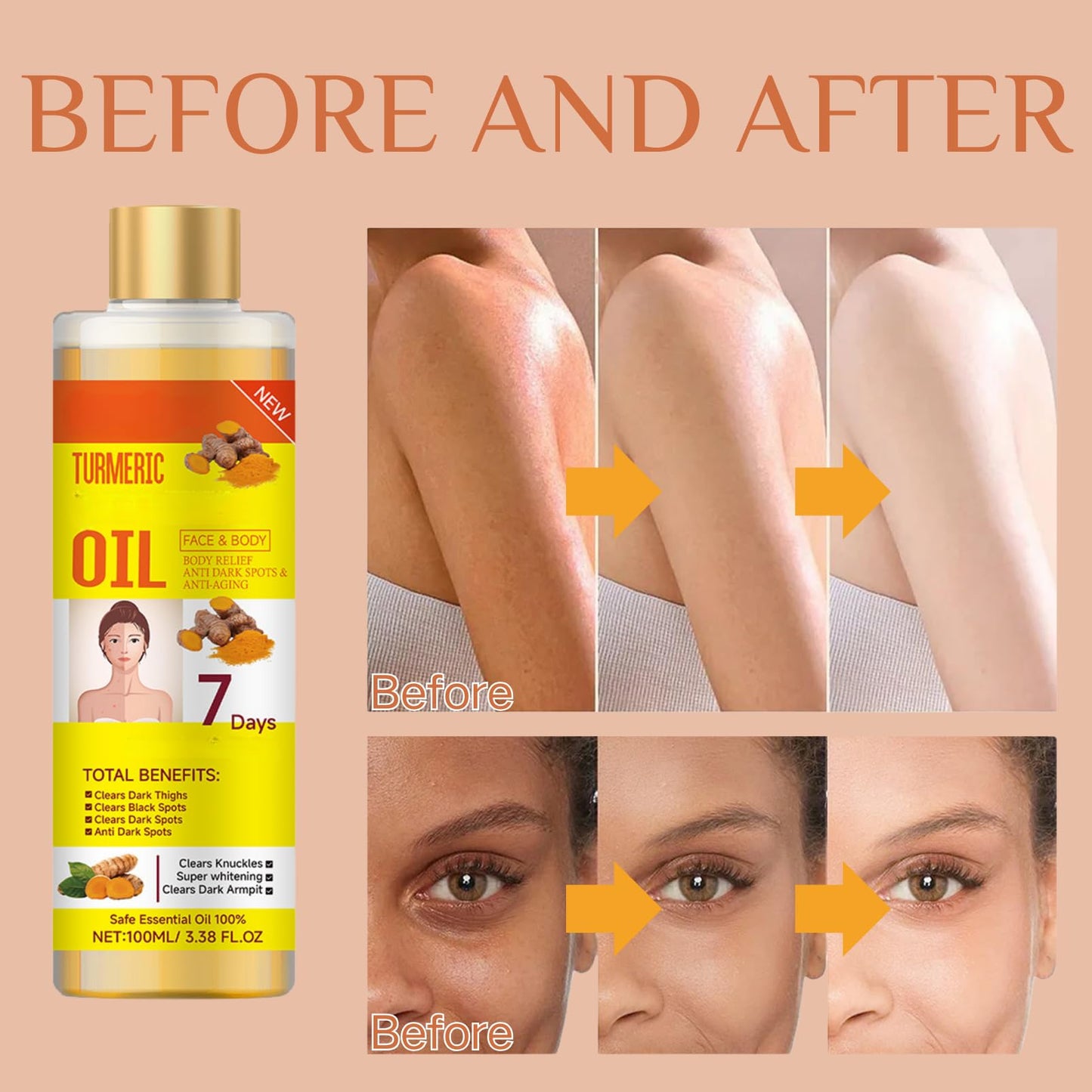 ISBEAUSOLS Turmeric Body Oil for Women - Essential Oils for Skin - Body,Hair,Face Turmeric Oil - Body Oil For Dry Skin - Turmeric Massage Oil For Dark Spots - Nourish,Moist 100ml