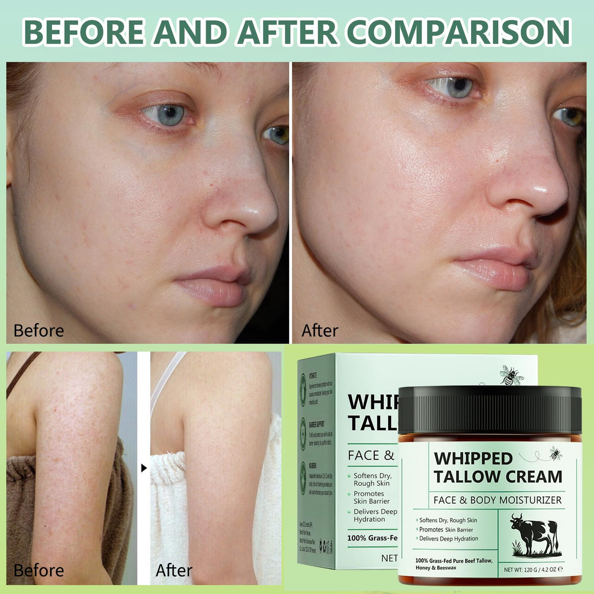 Wormeer Beef Tallow for Skin Care 120g, Honey Balm, Beef Tallow Moisturiser, Grass-Fed Whipped Face Cream with Raw Honey, Deep Hydration for Women