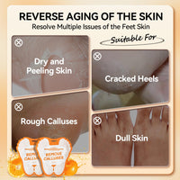 LANBENA Vitamin C Foot Peeling Mask, Foot Mask for Dry Cracked Feet, Exfoliator Peel Off Calluses Dead Skin Callus Remover, Repair Rough Heels & Get a Baby Soft Feet for Men and Women(2 Pairs)