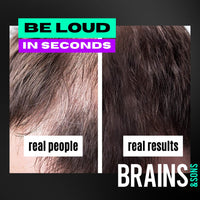 Brains & Son Hair Fiber - Premium Hair Thickener – Immediately Conceals Receding Hairlines, Hair Loss, Balding Areas and Thinning Hair – Undetectable Keratin Fibers - Hair Powder | 25g (BLONDE)