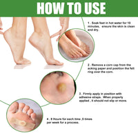 ShengQiu 30pcs Wart Remover,Verruca Treatment,Wart Remover for Hands,Plantar Wart R/emover for Feet,Effective Deep Verruca R/emoval Pads Patches for Adults