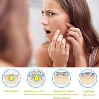 DERDOUT 3 boxes of 3 colors of water-based gel acne patches, absorb liquids and reduce redness and swelling, cute star shaped (32 pills per box)