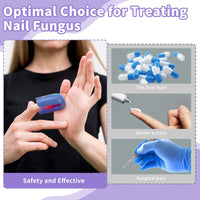 HaSoCare Nail Fungus Device, Fungal Nail Treatment, Antigungal Device for Toenail Fingernail and Onychomycosis