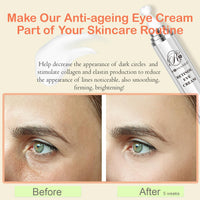 ROSVANEE Retinol Eye Cream, Daily Anti-Aging Under Eye Cream with Hyaluronic Acid, Vitamin E, Niacinamide to Fight Eye Puffiness, Fine Lines, Wrinkles, & Dark Circles, 20ml