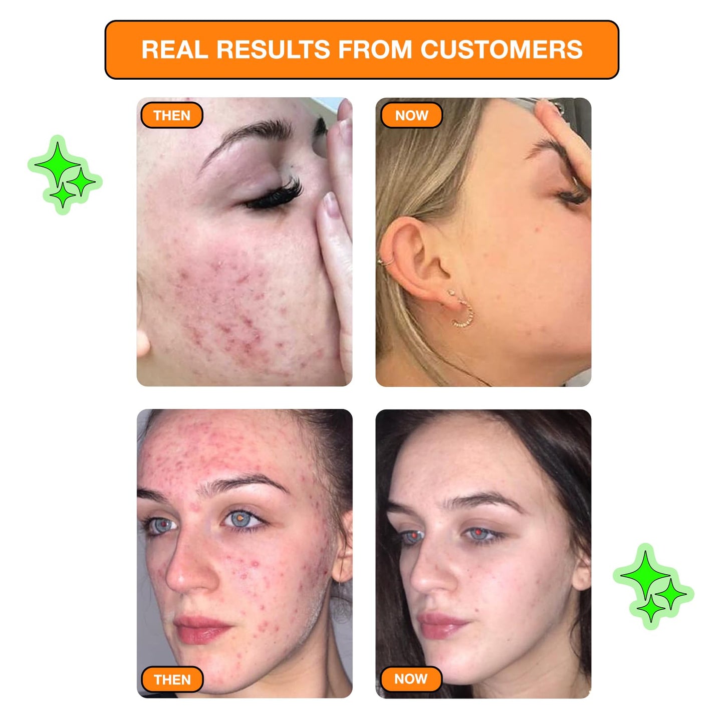 Carbon Theory Vitamin C Serum for Face - Brightening Serum to Boost Skin Glow - Dark Spots & Pigmentation Treatment - Vitamin C Face Serum & Glycolic Acid Serum - Vegan - SupaVIT-C Pow, 30ml