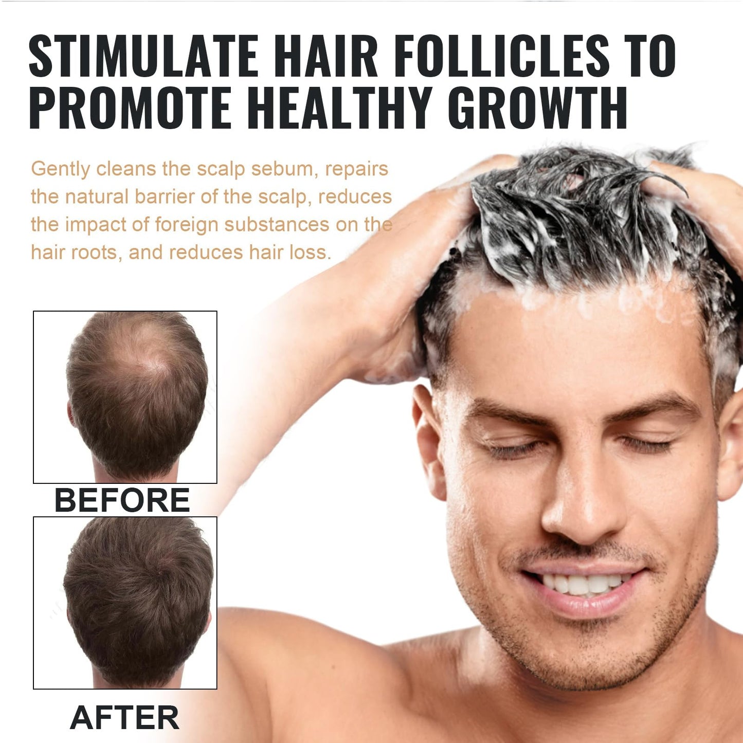 KOAHDE Man Root Activator Shampoo,Root Activator Shampoo,Root Activator Shampoo for Men,Hair Growth Shampoo,Shampoo for Thinning Hair and Hair Loss,Natural Herbal Essence Shampoo,with Scalp Comb