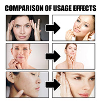 Kojic Acid Cream,Skin Lightening Cream for Anti Aging,Dark Spot Correcting Glow Serum,Dark Spot Corrector,Dark Spot Remover for Face,Spot Cream,Face Moisturizer for Women,Dark Spot Cream,Spot Gel