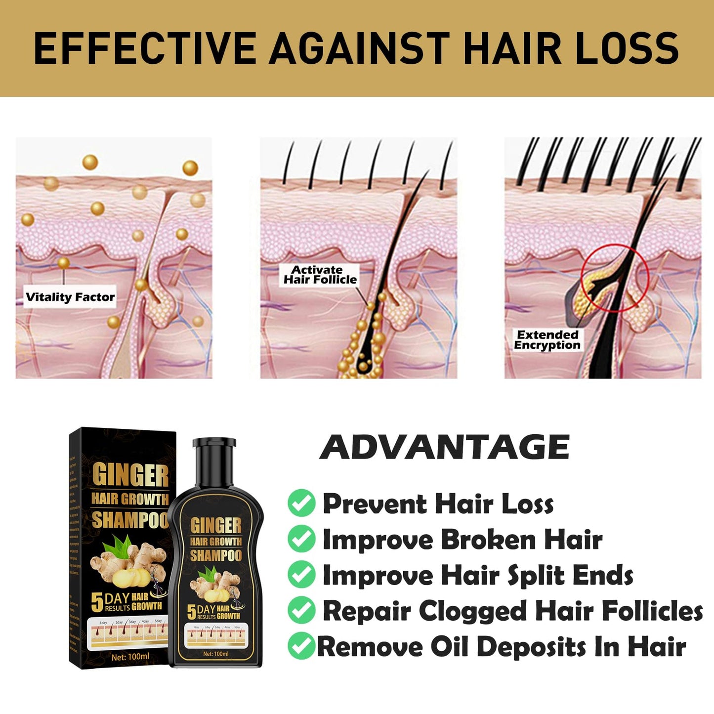 Ginger Hair Growth Shampoo, Ginger Shampoo, Anti Hair Loss Shampoo, Natural Organic Ginger Shampoo Promotes Hair Growth, Anti-dandruff & Anti-itching Ginger Shampoo for Hair Loss Women Men (2Pcs)