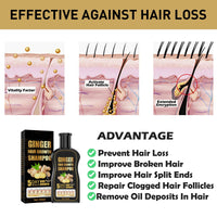 Ginger Hair Growth Shampoo, Ginger Shampoo, Anti Hair Loss Shampoo, Natural Organic Ginger Shampoo Promotes Hair Growth, Anti-dandruff & Anti-itching Ginger Shampoo for Hair Loss Women Men (2Pcs)