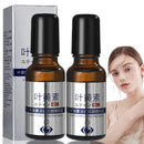 2Pcs Lutein Eye Essence Oil,Lutein Rollerball E/ssence for E/yes,VC Lutein Anti-Wrinkle Essence Oil,Ey/e Cream for Wrinkles,Anti Aging Serum for E/ye,Moisturizing Skin for Eye Bags,Eyebag Remover