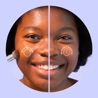 ZitSticka UNDERCOVER Blemish Patches