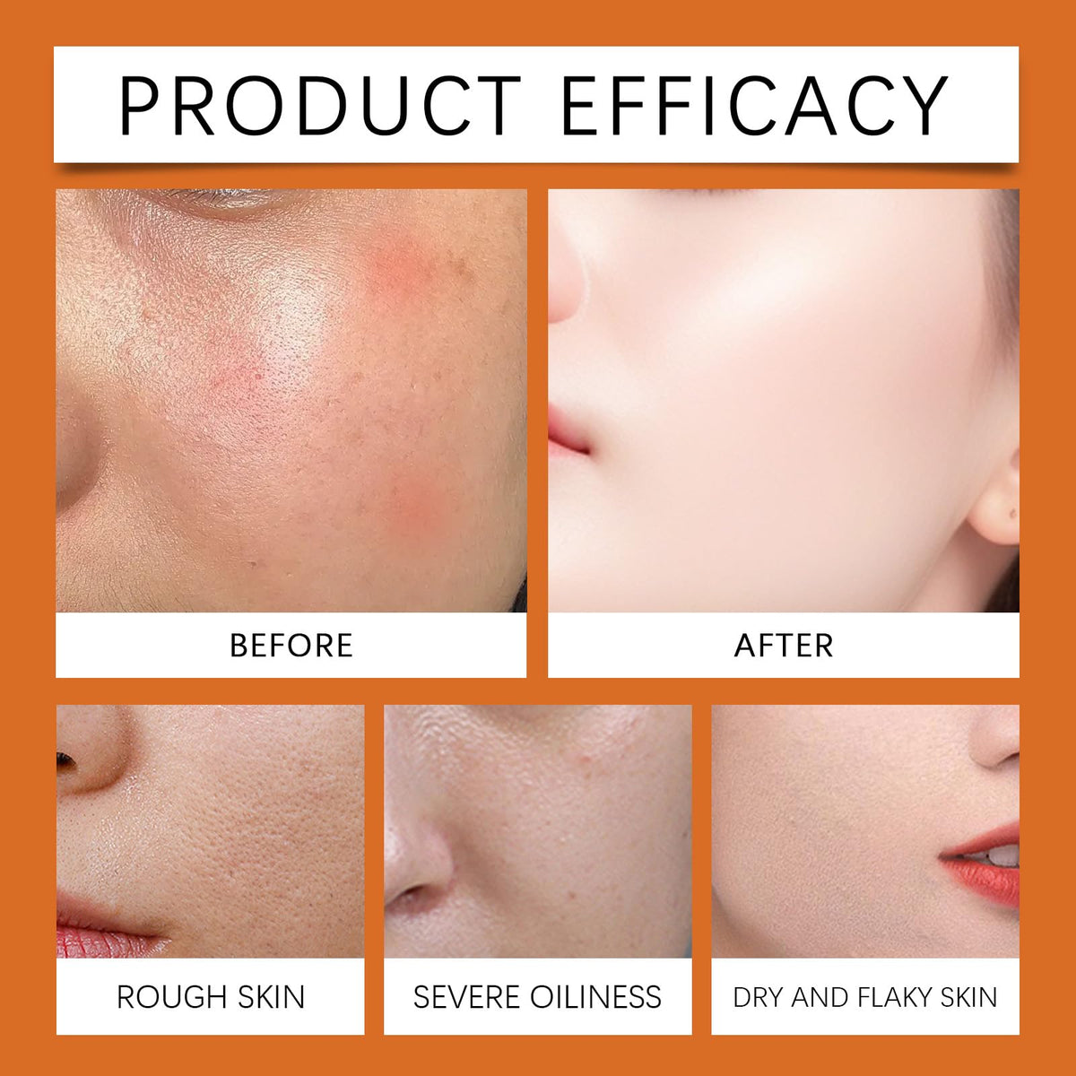 ISBEAUSOLS Bee Venom Firming Serum Stick - Flysmus Firming Serum Stick - Skin Tightening Cream For Face - Advanced F-irming & Wrinkle-Reducing Day & Night Serum - Face S-erum for All Skin Types