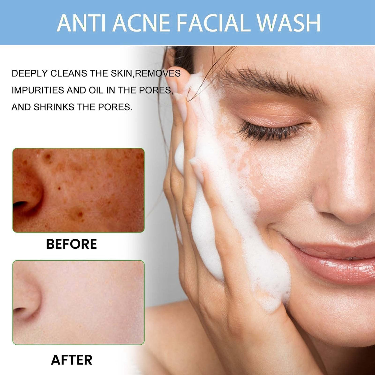 Mubuni Acne Foaming Wash,Mild Daily Facial Cleanser for Deep Pore Cleansing,Acne Foa/m Wash,Gentle Daily Cleans/ing Foam,Clea/nsing Fo/am for Women,Facial Wash Women to Soothe Redness,Exfoliating Face Wash