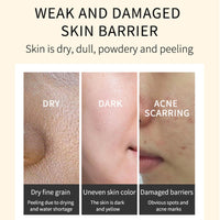 SONGQEE Turmeric Face Cream - Anti Aging Cream For Radiant&Glowing Skin - Dark Spot Corrector Remover For Face - Natural Turmeric Cream Skin Care - Moisturizing Erase Fine Lines, Brightening, Firming