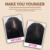 Sevich Hairline Powder，Instantly Conceals Hair Loss, Root Touch up Powder, Hair Shadow Toppers for Women & Men, Touch Up for Thinning Gray Hair, Windproof & Sweatproof,Grey