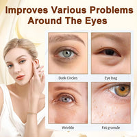 QUIWEN Caffeine Eye Serum, Under Eye Cream for Dark Circles and Puffy Eyes, Day & Night Eye Cream Anti Aging with 360° Massage Ball, Reduce Fine Lines Wrinkles Eye Bags, Eye Roller Cream for Men and Women