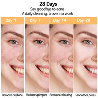 Snail Mucin Facial Cleanser - Face Wash for Women Men - Hydrating Face Cleanser - Travel Size Cream Cleanser Fine Foam Deep Pore Cleansing Moisture Locking for Dry & Oil Skin Care