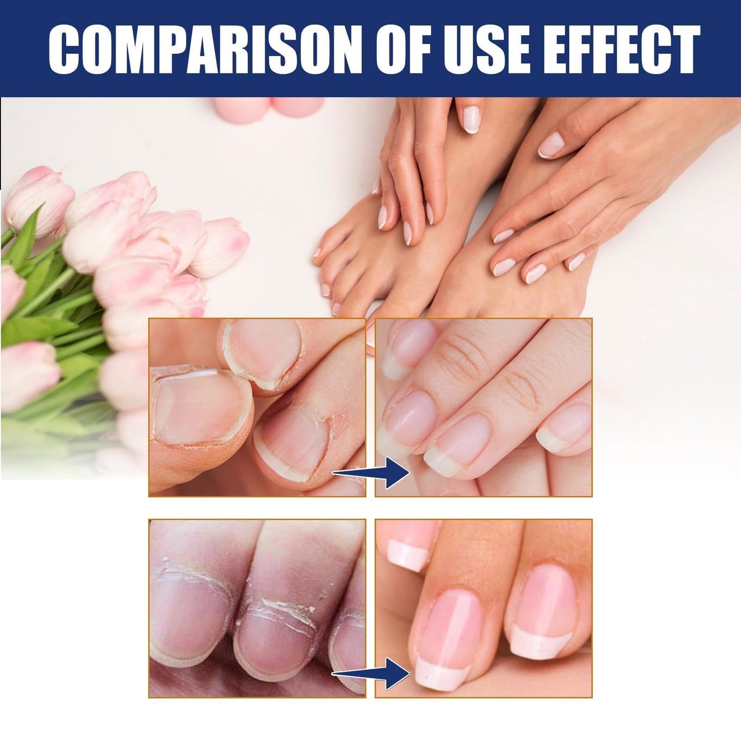 OunTechGlory Nail Strengthener for Damaged Nails - Nail Hardener Extra Strong and Growth - Revitalizing Fingernail Growth Serum - Strengthens and Hardens Weak Nails for Faster Growing