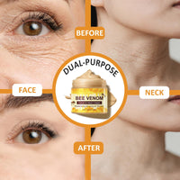 Shengqialun Bee Venom Cream With Honey - Face & Neck Anti Wrinkle Cream For Fine Line - All-in-One Face Moisturiser For Tightening, Wrinkle Removal & Anti Aging