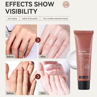 DMQ 2PCS Retinol Hand Cream, Firming Anti-Aging Hand Lotion with Collagen, Relief Intense Moisture Hand Cream, Retinol Moisturizer for Aging & Dry Cracked Hands, Care & Protects Skin, Nails & Cuticles