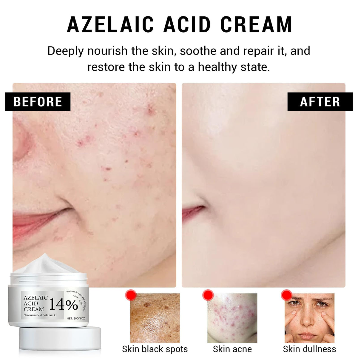 Asheyya Azelaic Acid Cream, Face Serum Skin Care Beauty with Niacinamide & Vitamin C