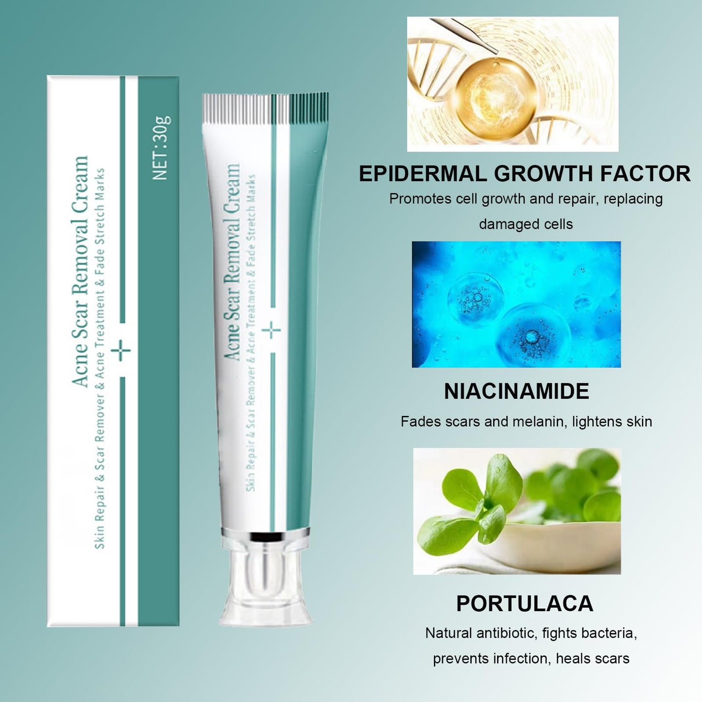 Shengqialun Herbal Scar Cream, Advanced Scar Treatment, Scar Healing Cream for Skin Repair, Scar Remover, Acne Treatment, Fade Stretch Marks, Scar Removal Cream Effective On Old & New Scars Face& Body