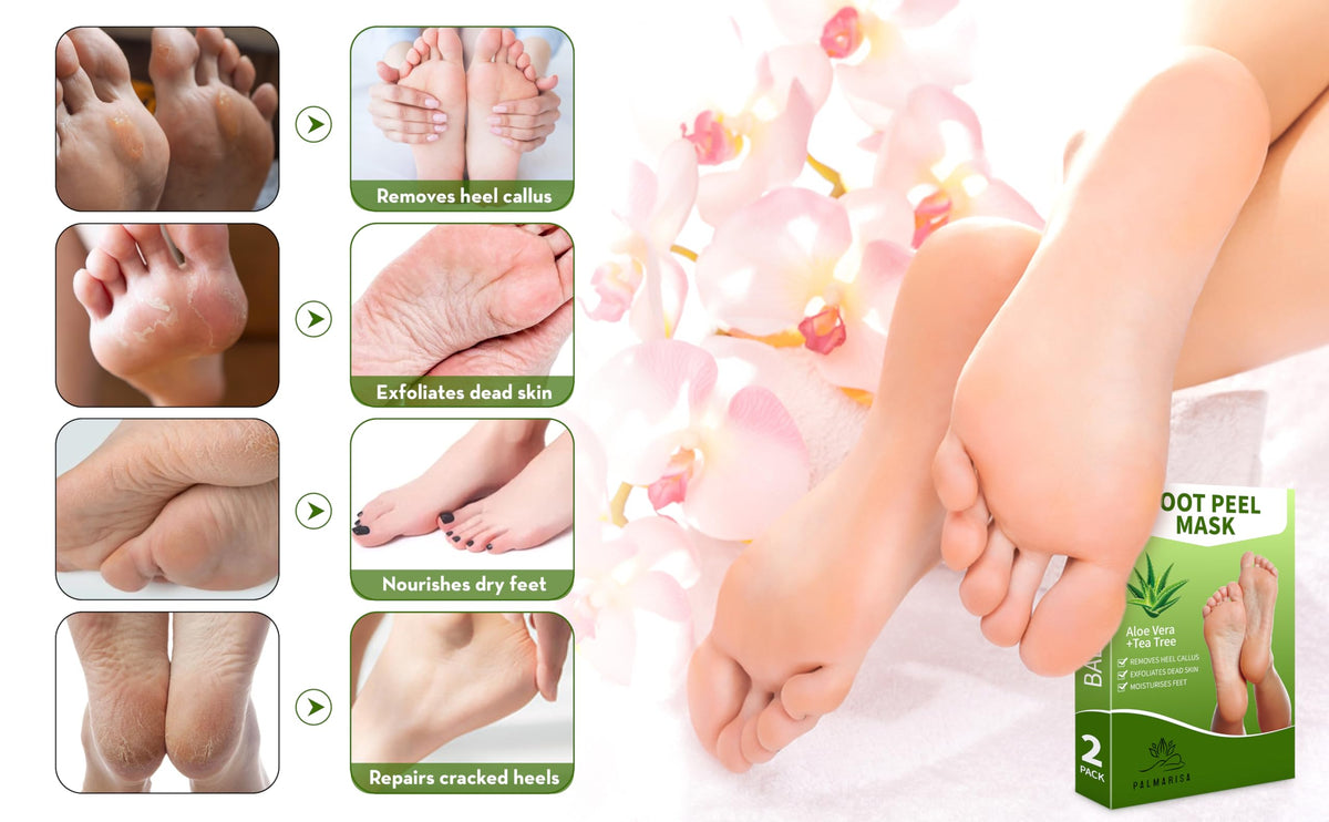 PALMARISA Palmarisa Foot Peel Mask – Exfoliating Socks for Cracked Heels & Hard Skin – Aloe Vera & Tea Tree – 2 Pairs – Baby Soft Feet in 10-14 Days, Dermatologically Tested