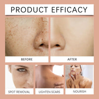 Dark Spot Remover Serum,D/ark S/pot Corrector Daily Face S/erum,Da/rk Sp/ot Correcting Glow Se/rum,Dark Spo/t Remover,Spot Treatment,Moisturiser Fa/ce Women,Face Oils for Women,Hydrating Serum