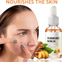 Leogony 2PCS Lightening Turmeric Serum Dark Spot Removal Corrector for Face Skin Glow, 30 ml, Anti Aging, Hydrating, Reduce Wrinkles