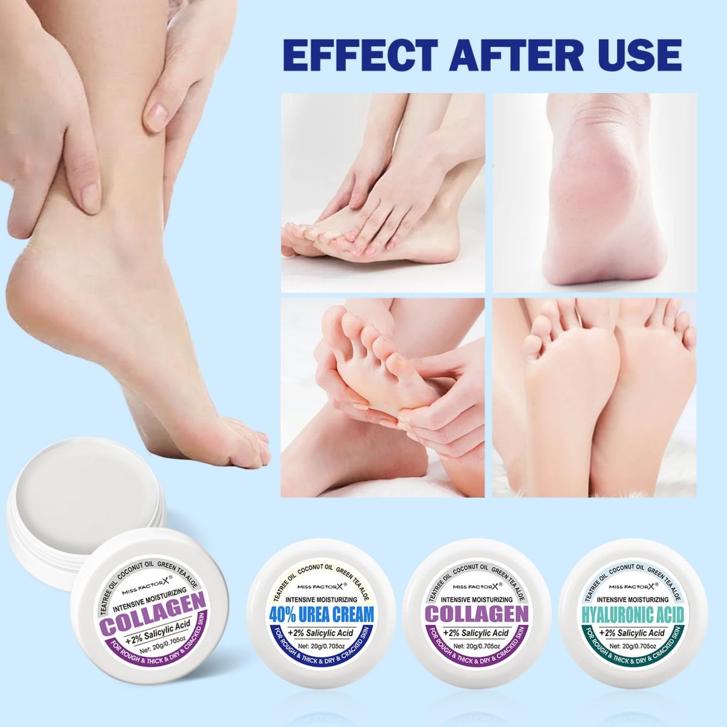 HERBINSOLS 40% Urea Cream - Foot Cream for Cracked Heels and Dry Skin - Foot Cream Kit, Urea, Collagen and Hyaluronic Acid, Plus 2% Salicylic Acid - Cracked Heel Repair Cream 60g (Pack of 3)