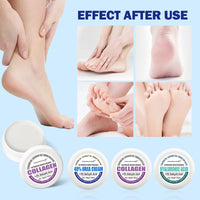 HERBINSOLS 40% Urea Cream - Foot Cream for Cracked Heels and Dry Skin - Foot Cream Kit, Urea, Collagen and Hyaluronic Acid, Plus 2% Salicylic Acid - Cracked Heel Repair Cream 60g (Pack of 3)