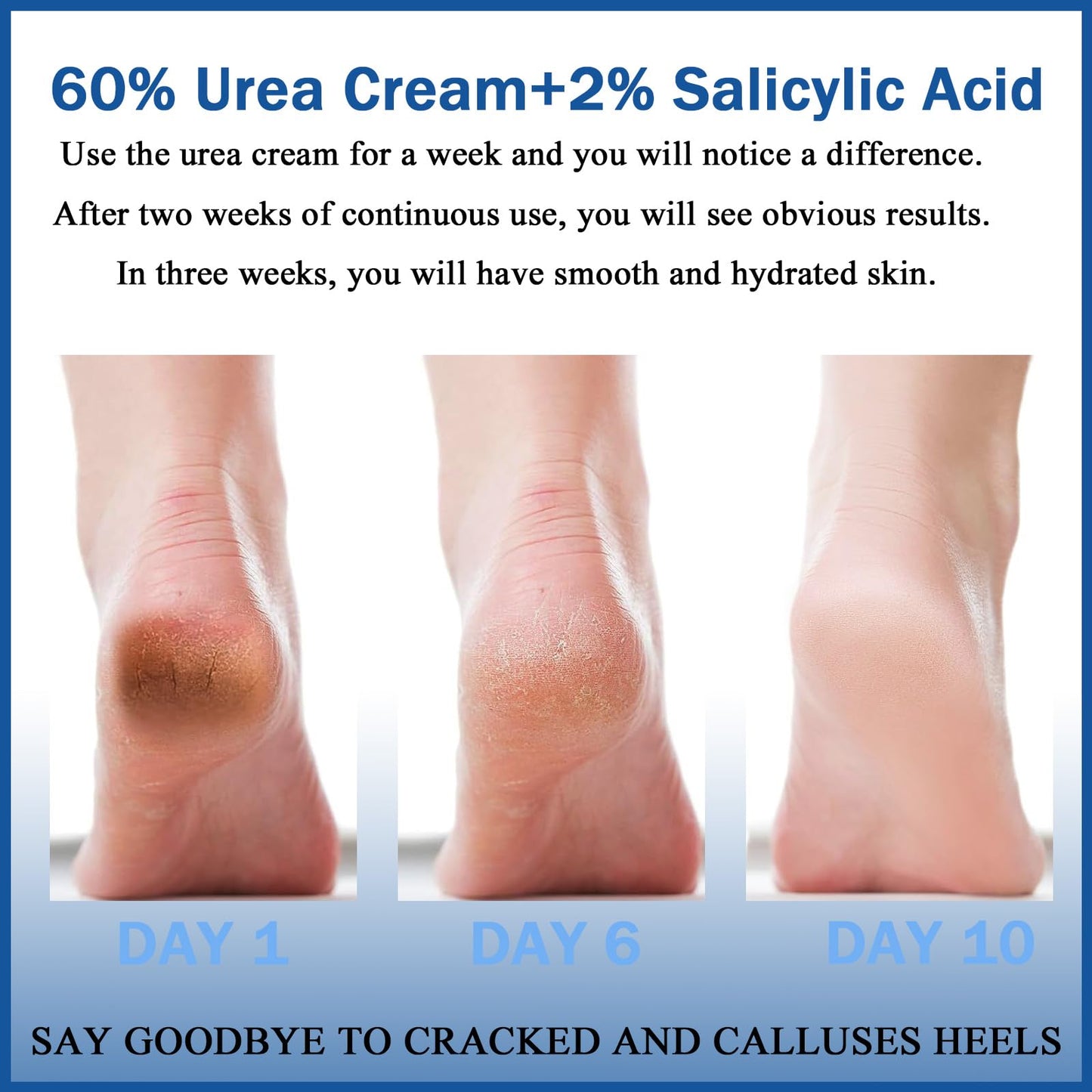 LUXRYNTH 2PCS Urea Cream 60% for Feet & Hands - Maximum Strength Foot Cream for Cracked Heels, Dry Skin Repair and Hard Skin Care - Moisturising Balm for Callus Treatment, Healthy Moisturiser