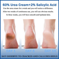 LUXRYNTH 2PCS Urea Cream 60% for Feet & Hands - Maximum Strength Foot Cream for Cracked Heels, Dry Skin Repair and Hard Skin Care - Moisturising Balm for Callus Treatment, Healthy Moisturiser