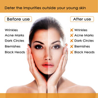 NUTRIGLOW Papaya Face Kit For Clearer, Blemish-Free Skin Moisturized And Brighter Skin, Fresh Appearance, All Skin Types, 260gm