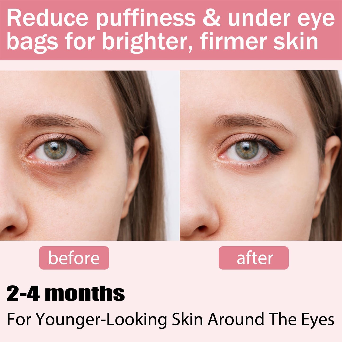 SEFUSON Eye Gel, Best Eye Cream for Appearance of Dark Circles, Puffiness, Wrinkles and Bags. Super Eye Cream Moisturizer Serum